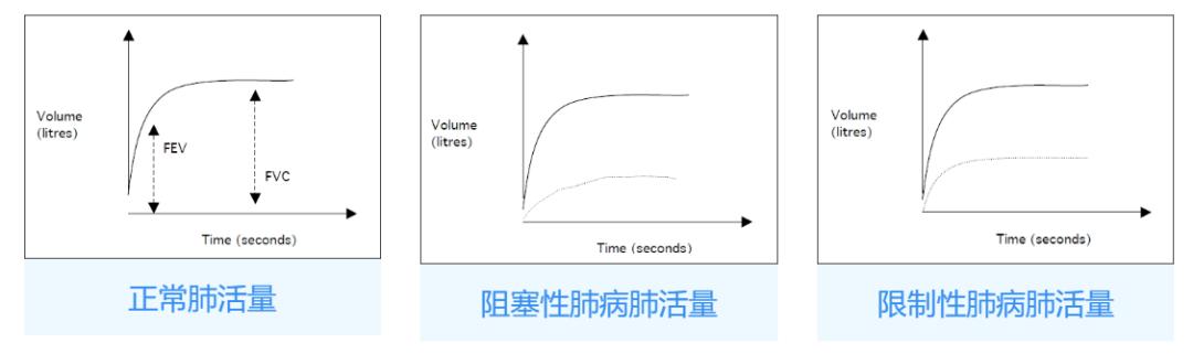肺功能报告单怎么看专家详解,肺功能几个指标的最新判定