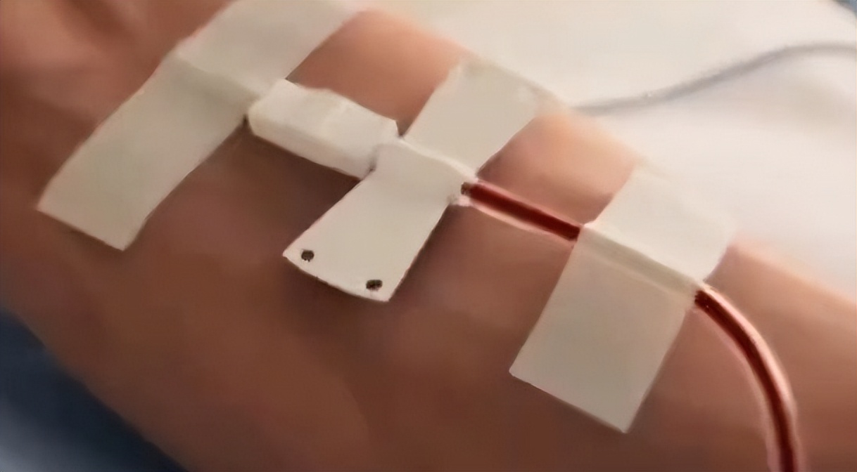 黄*血金**！宝鸡18岁女生血型为cisAB，出现概率为58万分之一