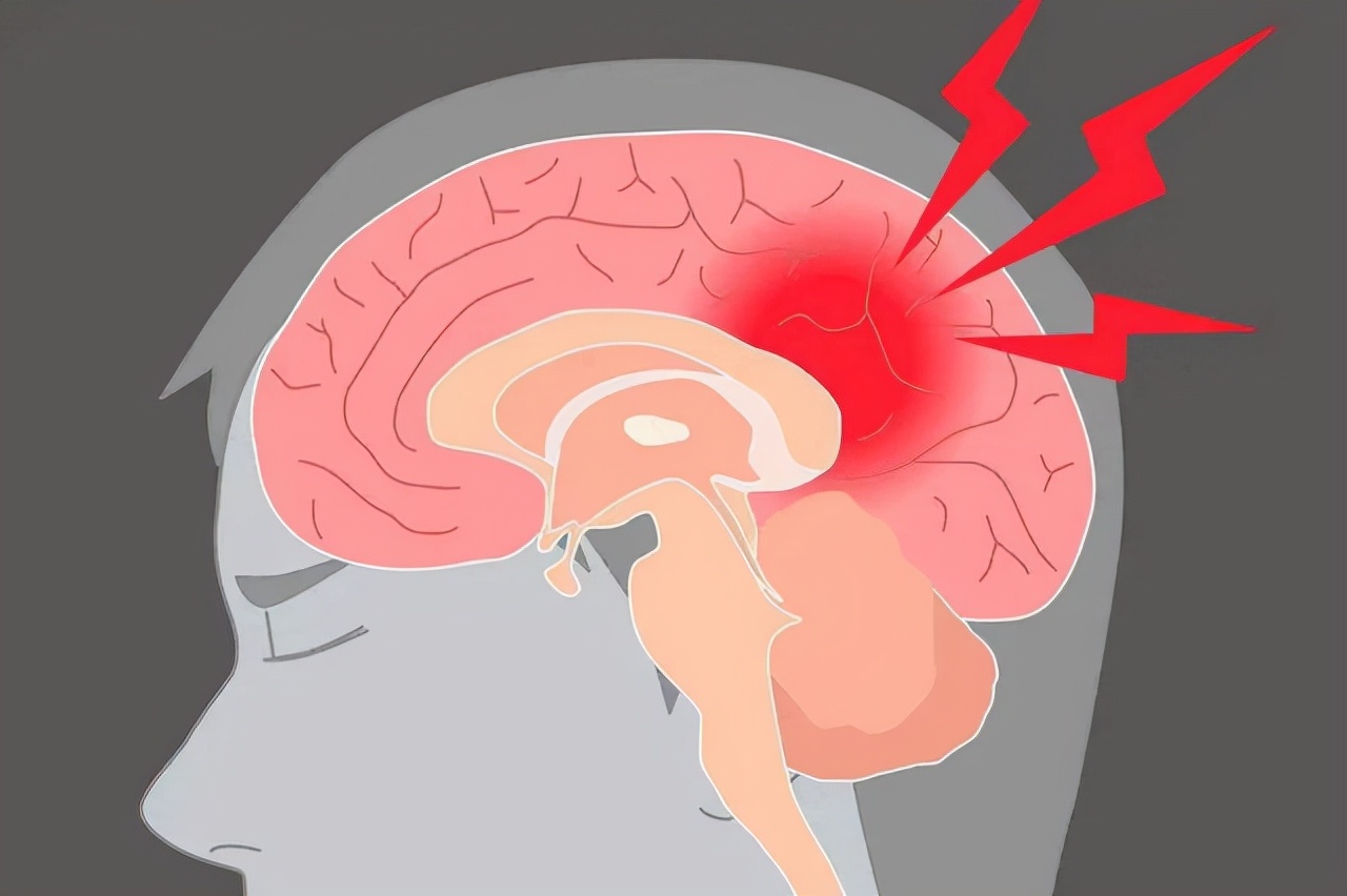 女性每天吃一片叶酸,女人每天吃叶酸有什么好处