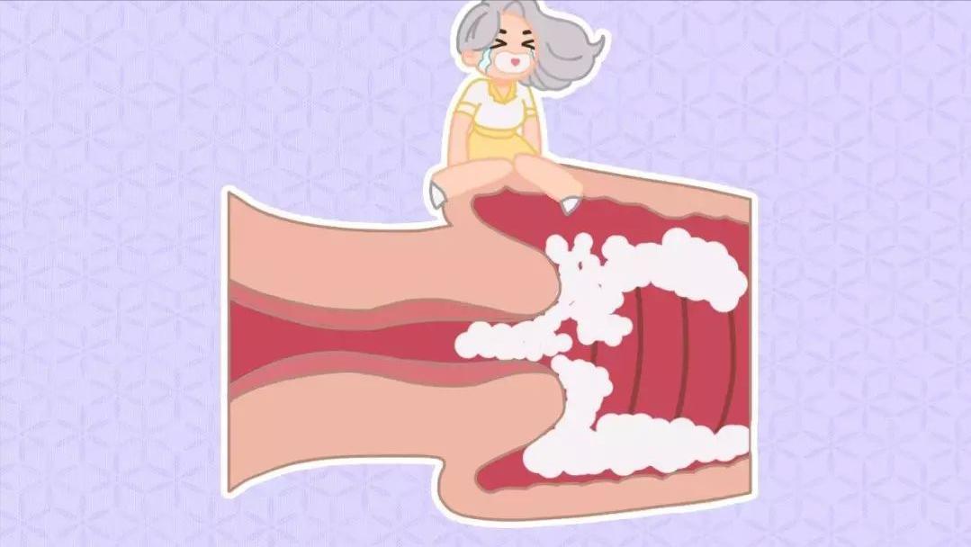 已婚女人妇科病是什么造成的,已婚女性长期分居会得妇科病吗