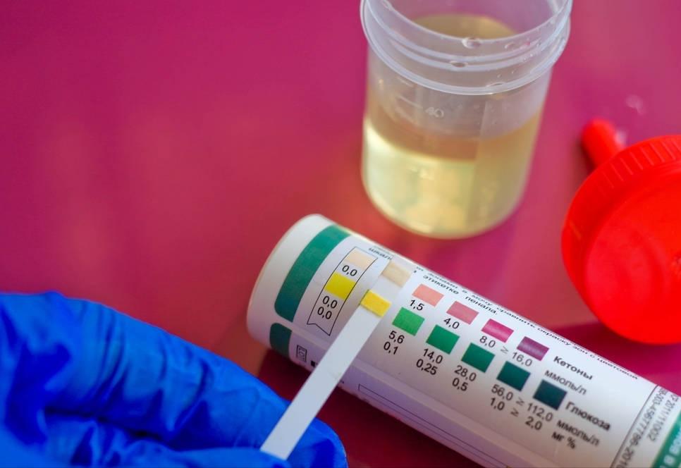 尿蛋白3+白蛋白正常怎么治疗,尿蛋白3+和尿蛋白2+哪个更严重