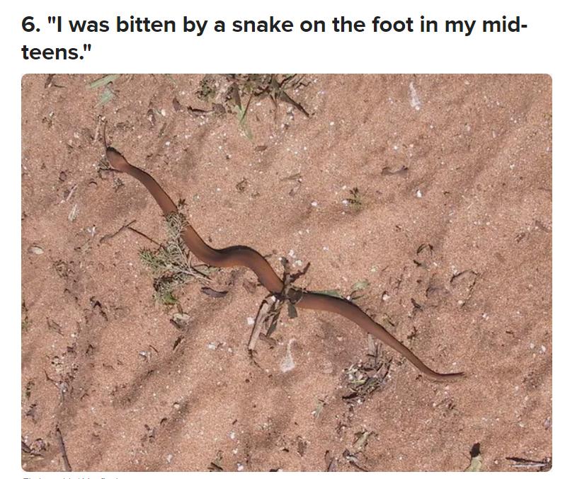 被毒的动物咬了会发生什么,亲身体验被有毒的动物咬