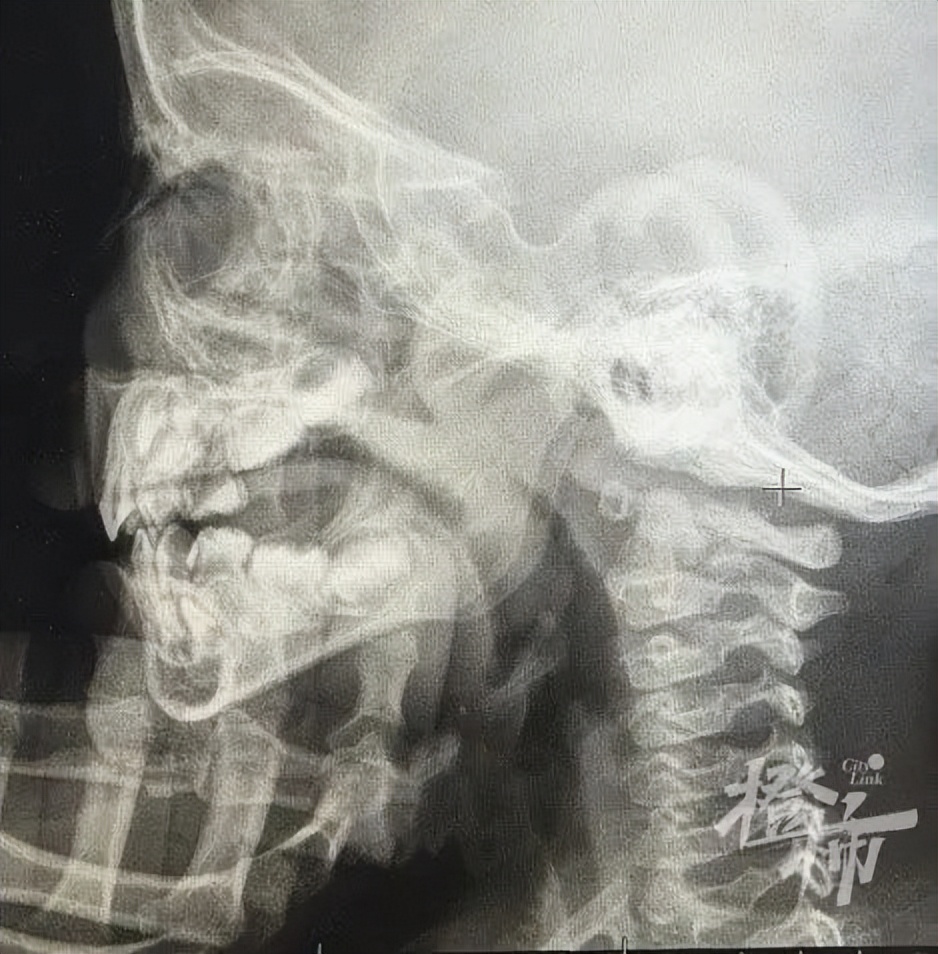 5岁女孩老是尿床怎么回事,7岁女童夜里尿床多次