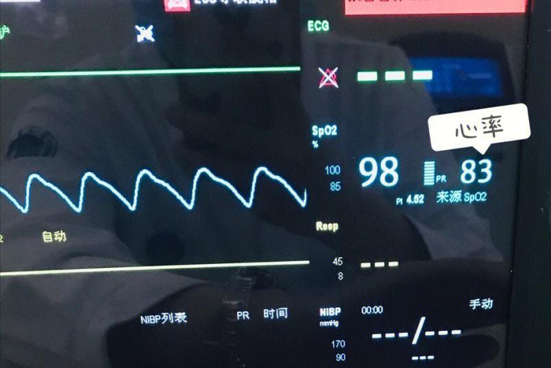 心肌梗死引起的血压低怎么办,心肌梗死引起的低血压怎么办