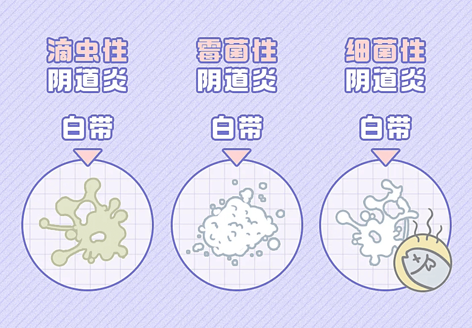 女大学生妇科检查隐瞒真相,大学女学生怀疑自己妇科病怎么办