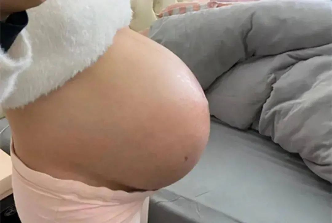 孕妈怀胎8个月，肚皮突然产生巨痒，婆婆一个做法救了她和孩子