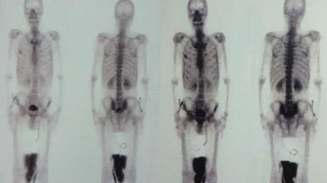 得了癌症应该问医生什么问题,癌症去看医生问诊应该怎么提问