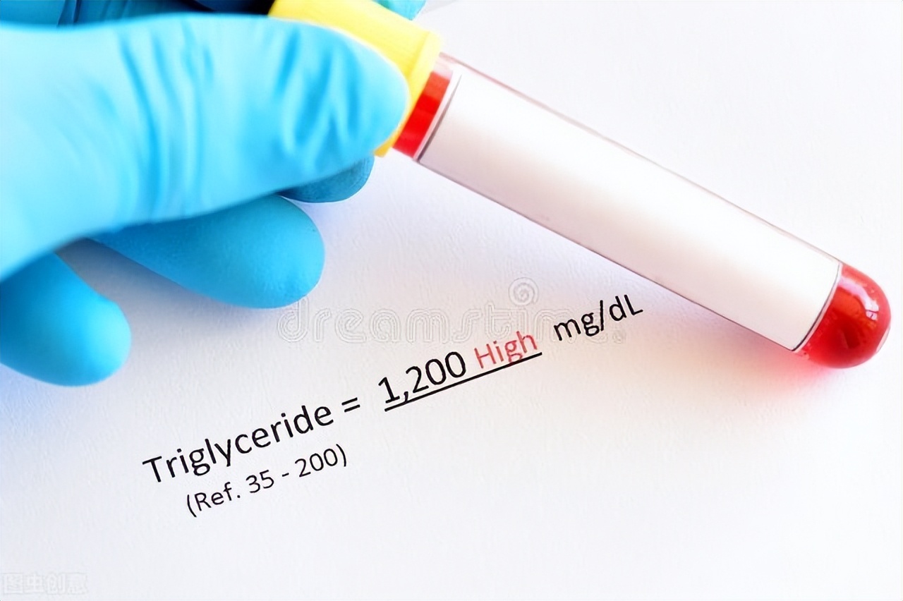 深海鱼油哪些成分对身体有益,什么样的鱼油是好鱼油