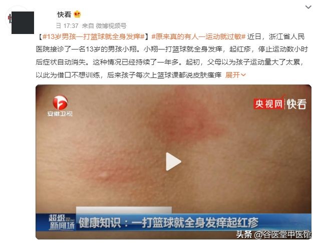 运动过敏的原因和危害,一运动皮肤就痒中医辨证