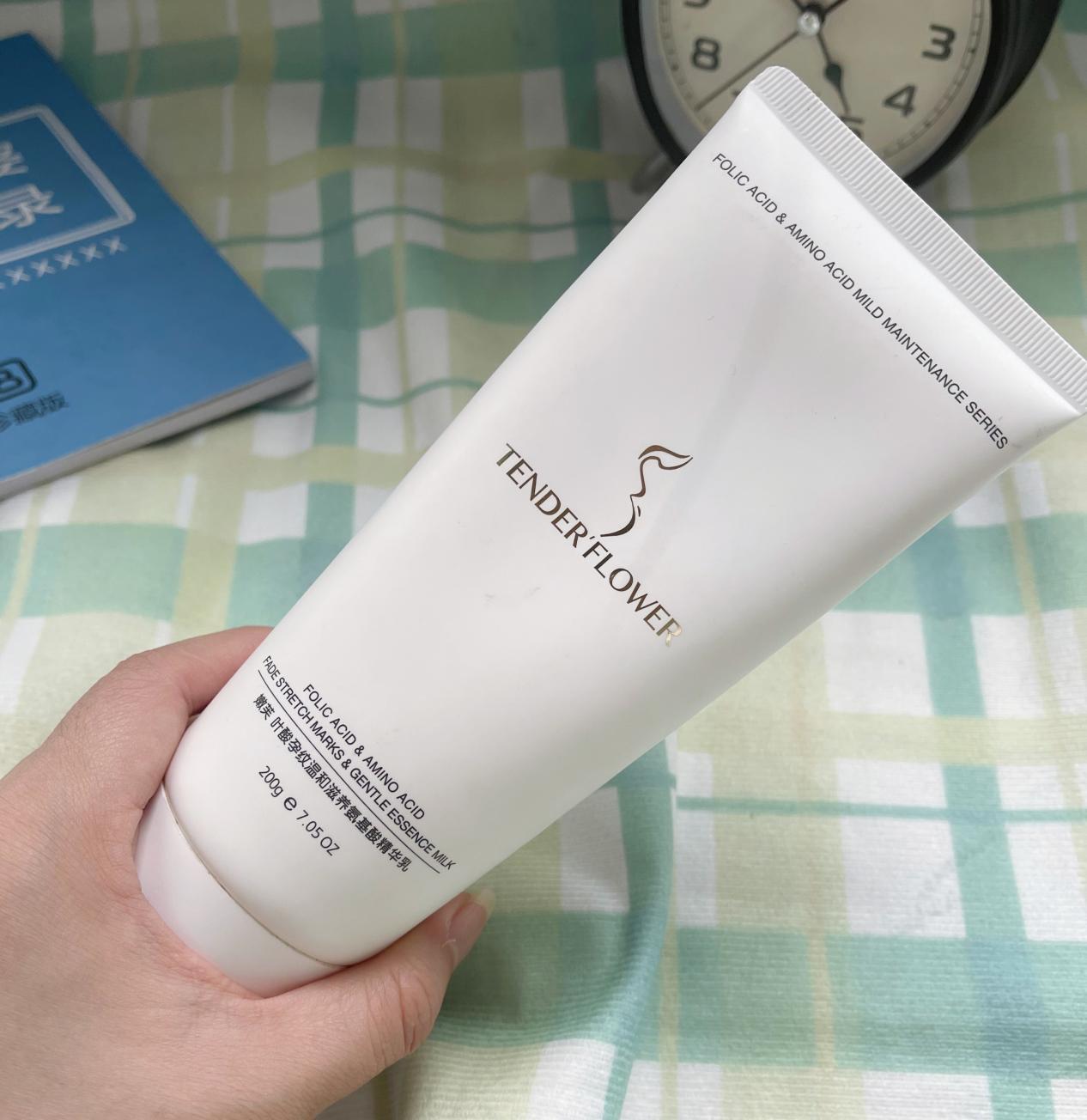 妊娠纹是挑人的吗,出现这四种征兆就是妊娠纹找上门