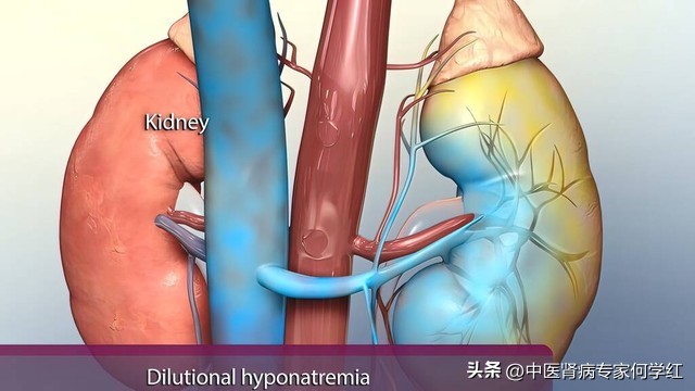肾功能检查肌酐高说明了什么,肌酐高不能吃什么