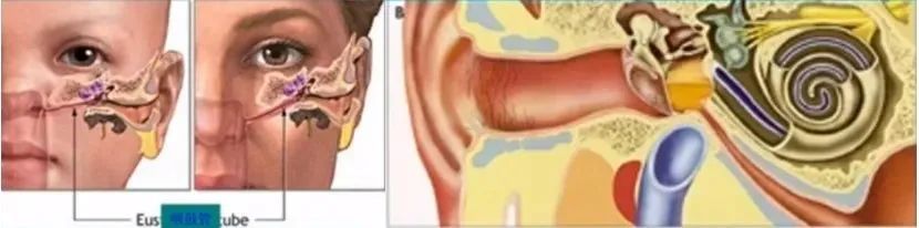 新冠中耳炎很快恢复妙招,新冠后中耳炎的症状表现