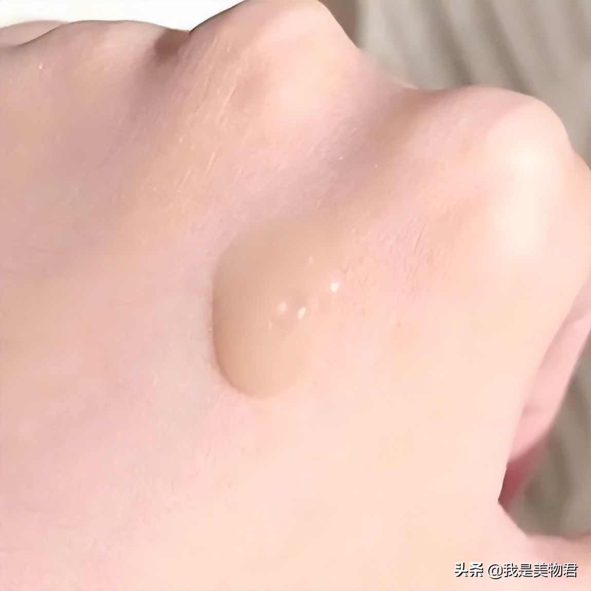 春敏的最佳治疗方法,春敏自救小妙招