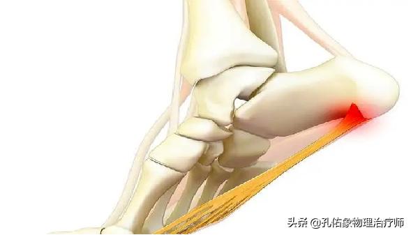 中老年人脚底痛是什么原因,老人脚底板好疼是什么原因