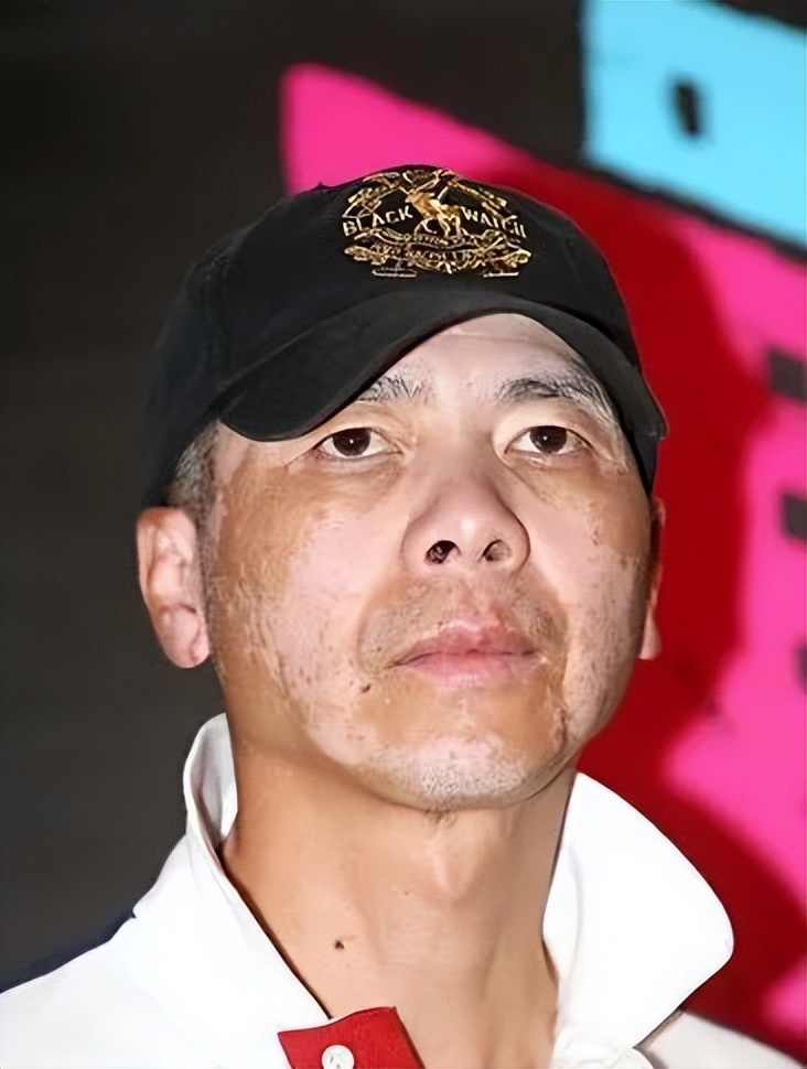 白癜风冯小刚症状,冯小刚谈不治白癜风的原因