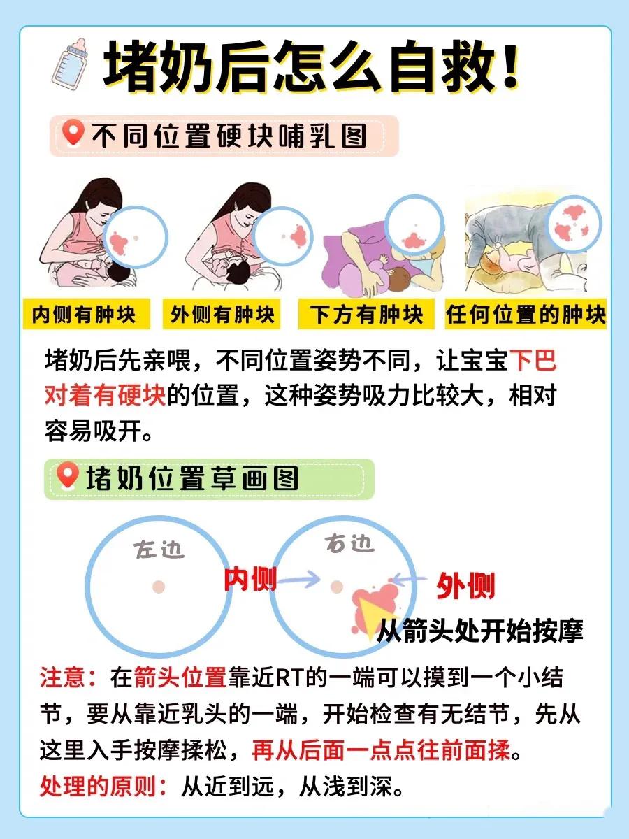 堵奶自救通乳,堵奶通乳手法教程
