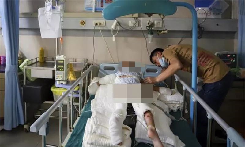 2岁女童被烧伤现场哭声让人揪心,6岁孩子被火烧伤后续