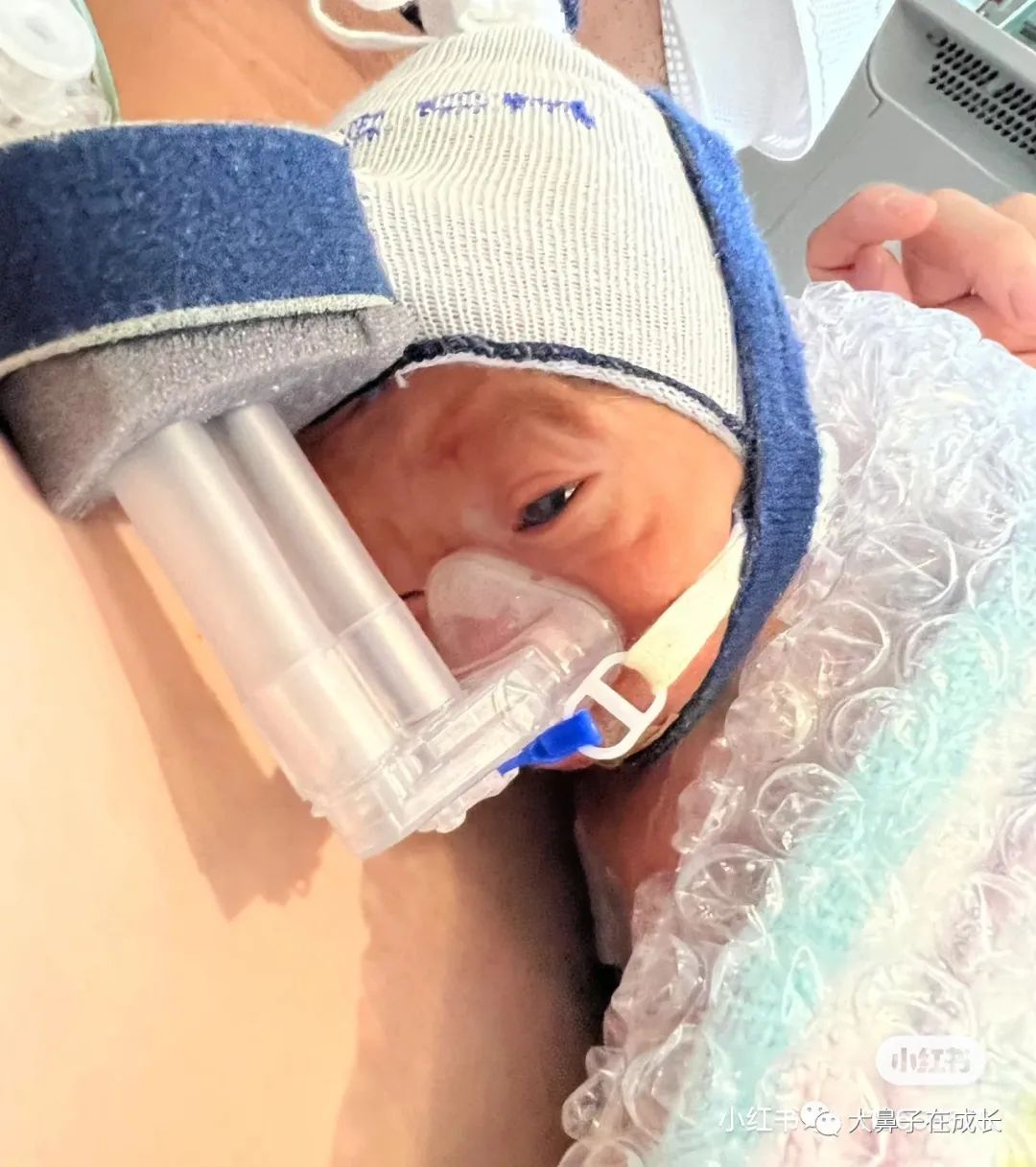 孕中险,孕期保险及胎儿保险