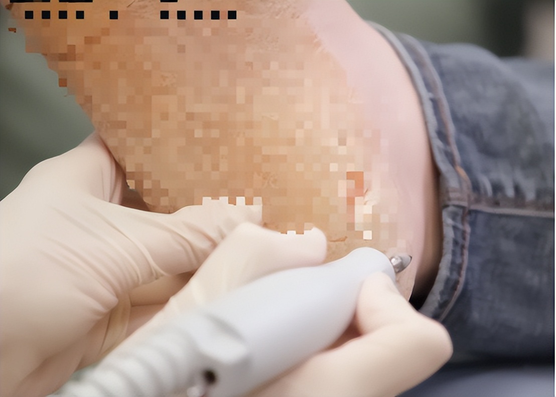 300斤美国女人,300斤胖女人美国