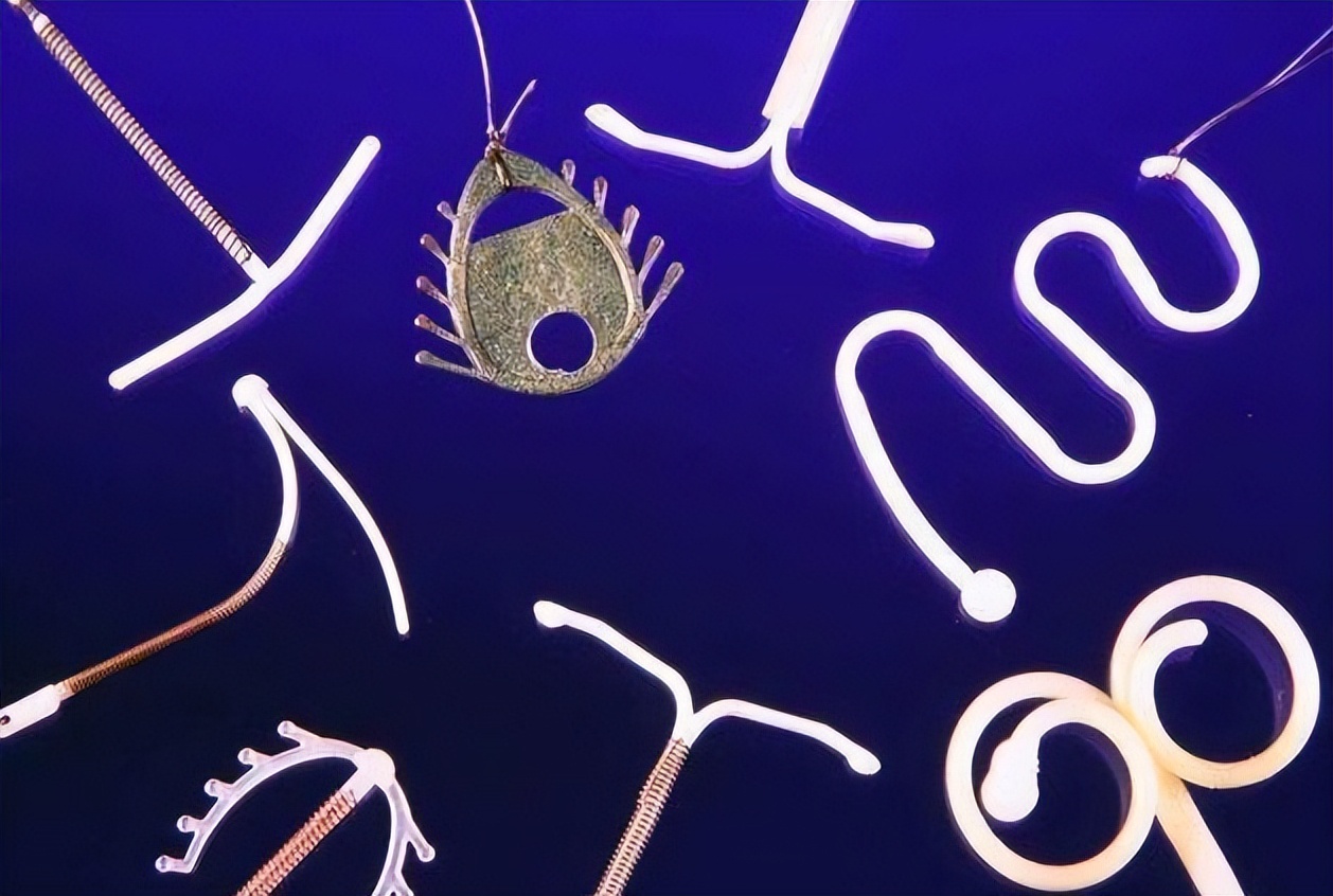 取节育环会有生命危险吗,节育环不取出来会得癌吗