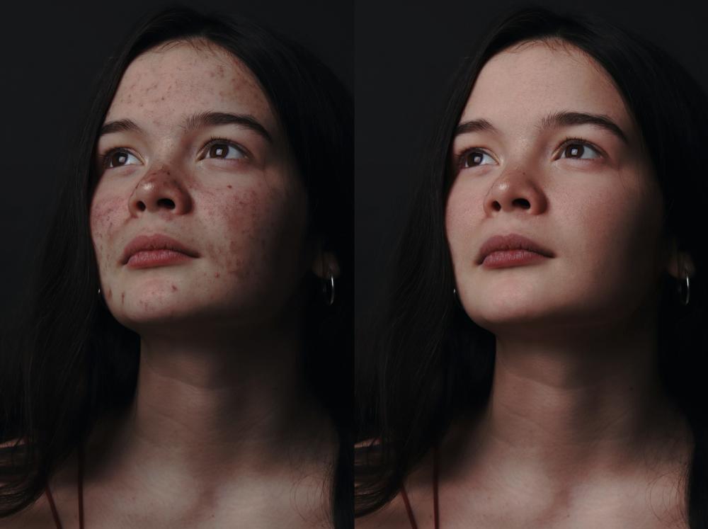 0代码体验效果,1行实现推理,10行搞定调优!101个CV模型开源