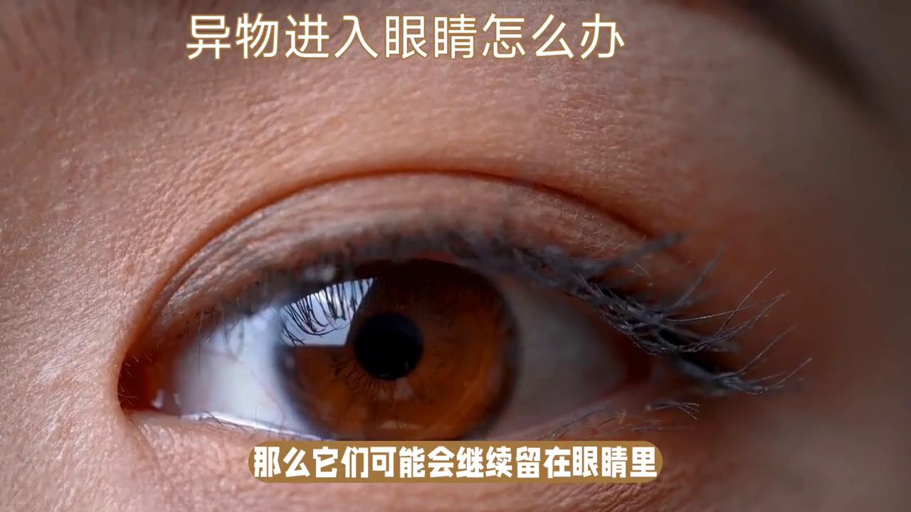 异物进入眼睛的治疗,异物入眼部的处理方法