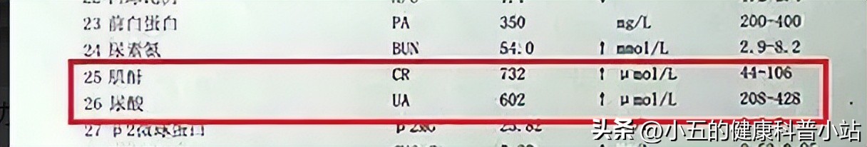 关节痛服塞来昔布多久见效,塞来昔布可以治疗肌肉酸痛