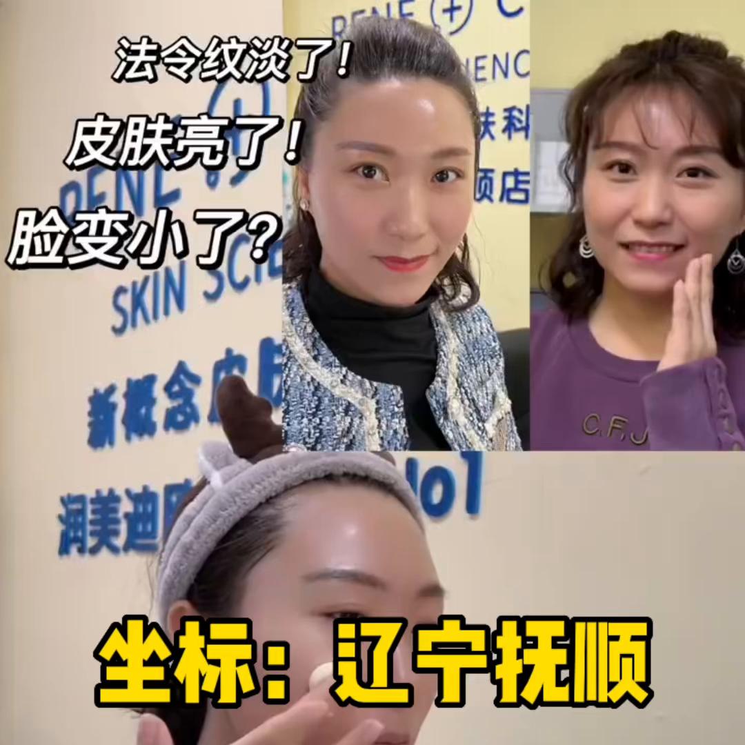 三颗润美迪欧钻石💎面膜，变化太大了#护肤分享