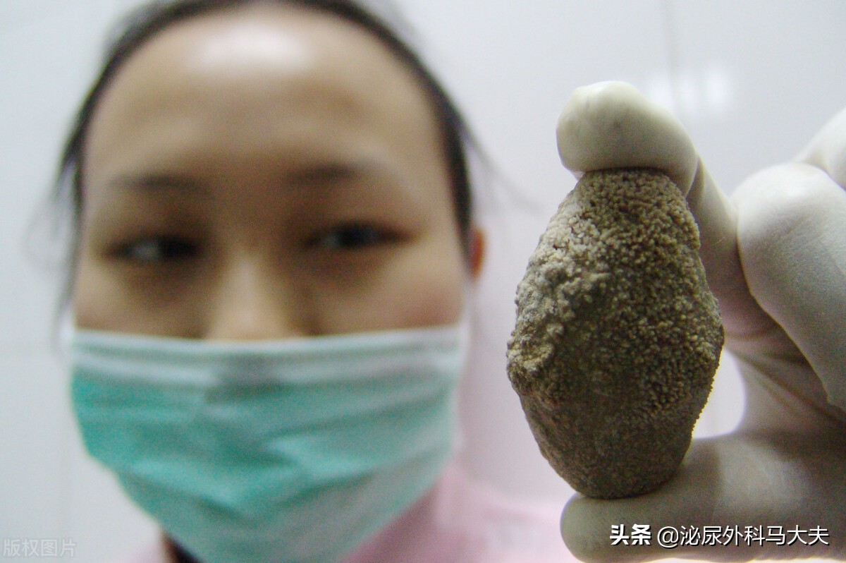 尿血就一定是癌症前兆吗？医生：不谈血色变，也不掉以轻心