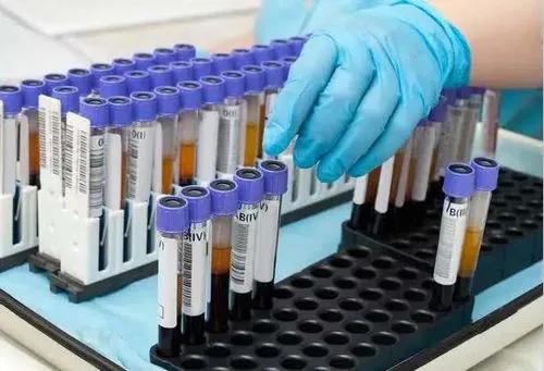 西西里尼罗猪的全基因组群体在意大利和世界性品种的框架