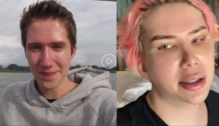 日本18岁女网红沉迷整容,韩国人气网红过度整容