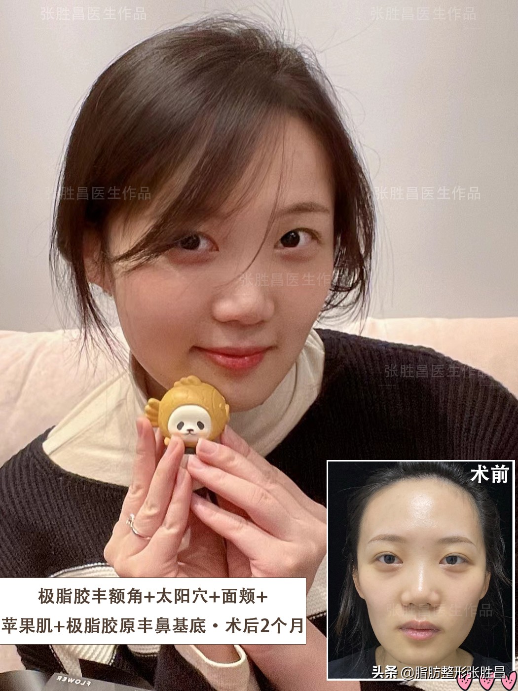 戴牙套矫正牙齿会有后遗症吗,女生28岁了建议矫正牙齿吗