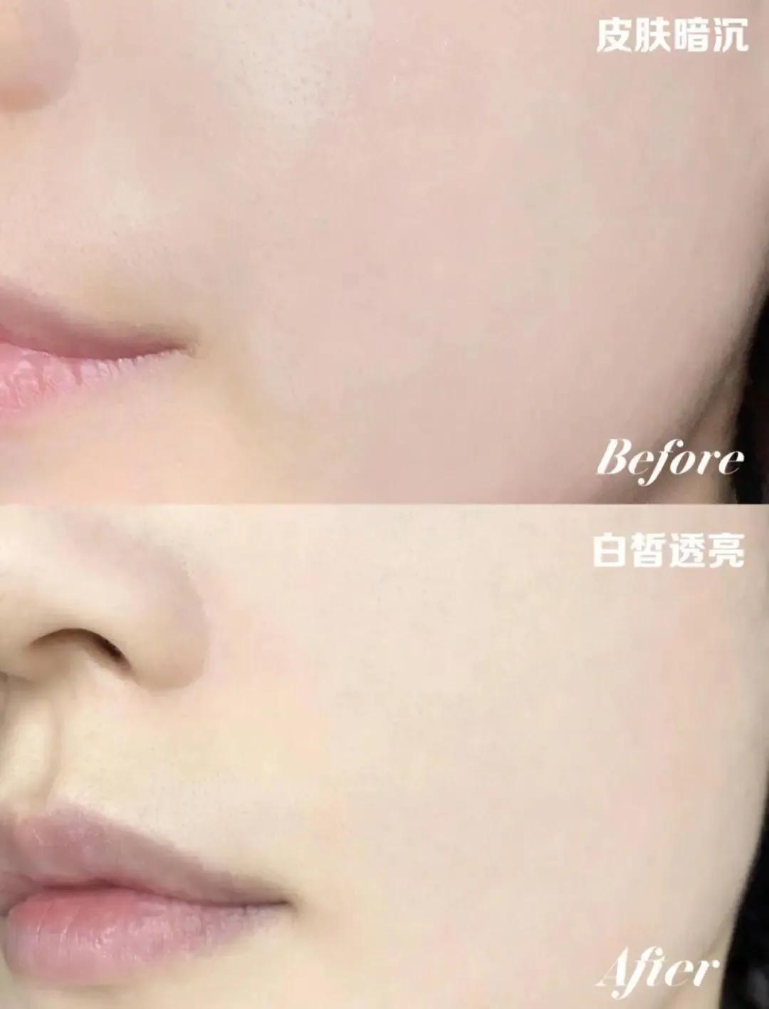 美白界再添黑马,美白黑马