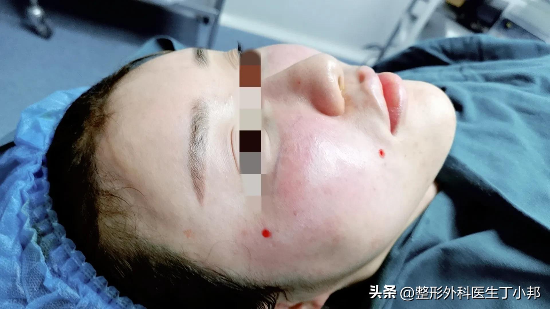 一个小姑娘毁容,一个女的毁容后才知道是救了自己