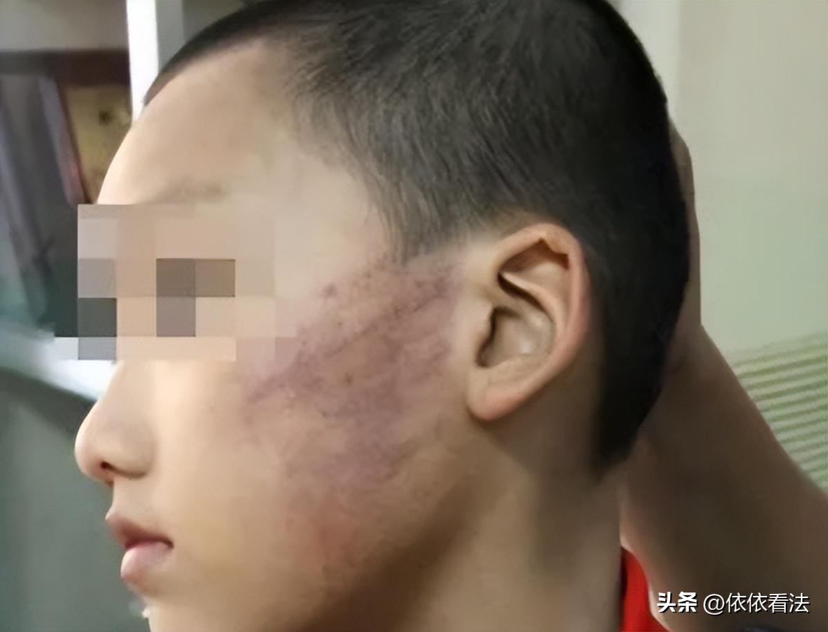 足球教练被侵害案例,女足教练涉强制猥亵罪被捕