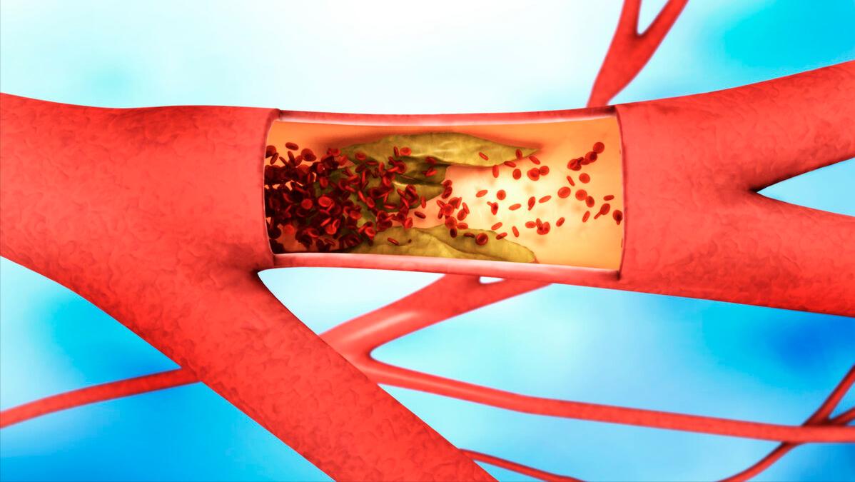 硒对心脏的好处专家讲解,含有硒的对心脏好的食物