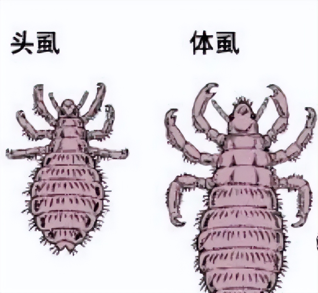 曾经的虱子怎么会灭绝了,为什么现在还有虱子存在