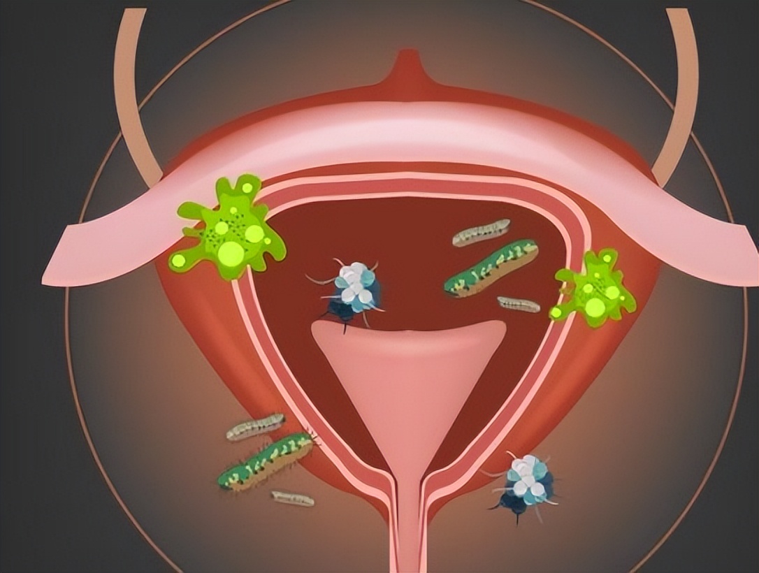 一喝水就尿多是肾脏不好吗,一喝水就尿多是肾脏不好