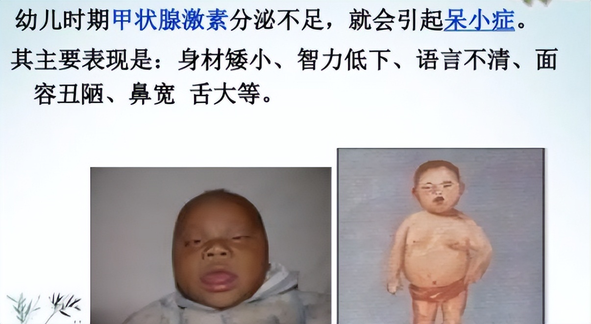 甲减导致的衰老还能好吗,每天感觉很累是甲减的问题吗