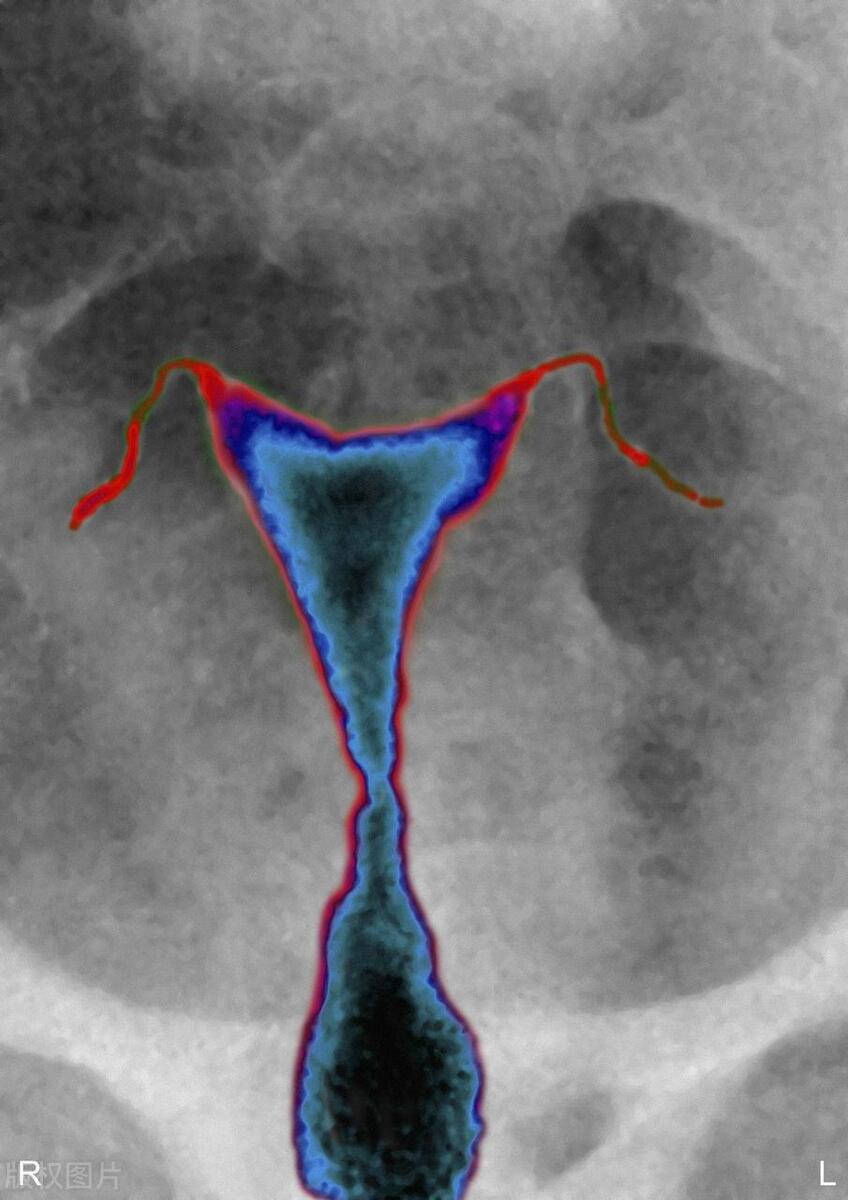 派特灵可以治疗妇科炎症吗,妇科炎症的病因