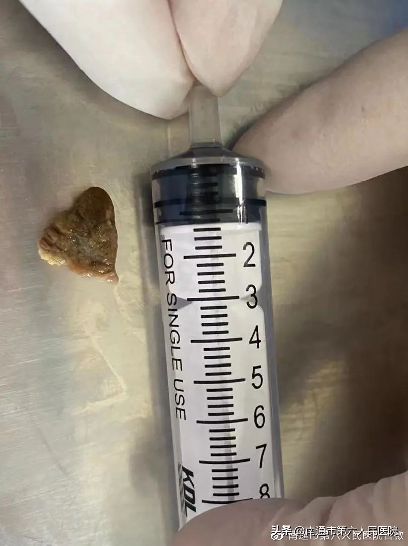 小镜子，大用途，一探究“镜”