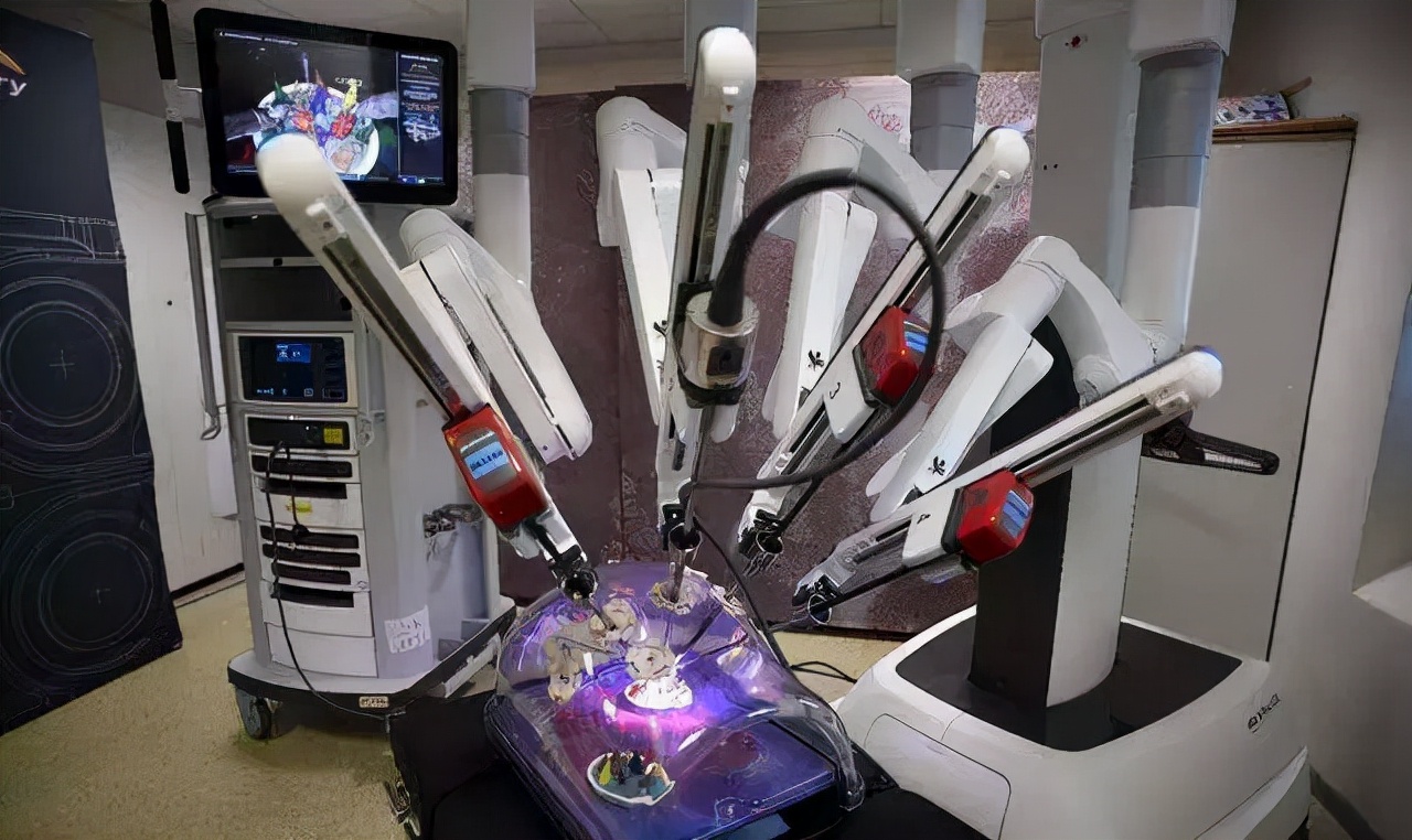 腹腔镜肾切除示意图,腹腔镜肾脏部分切除术