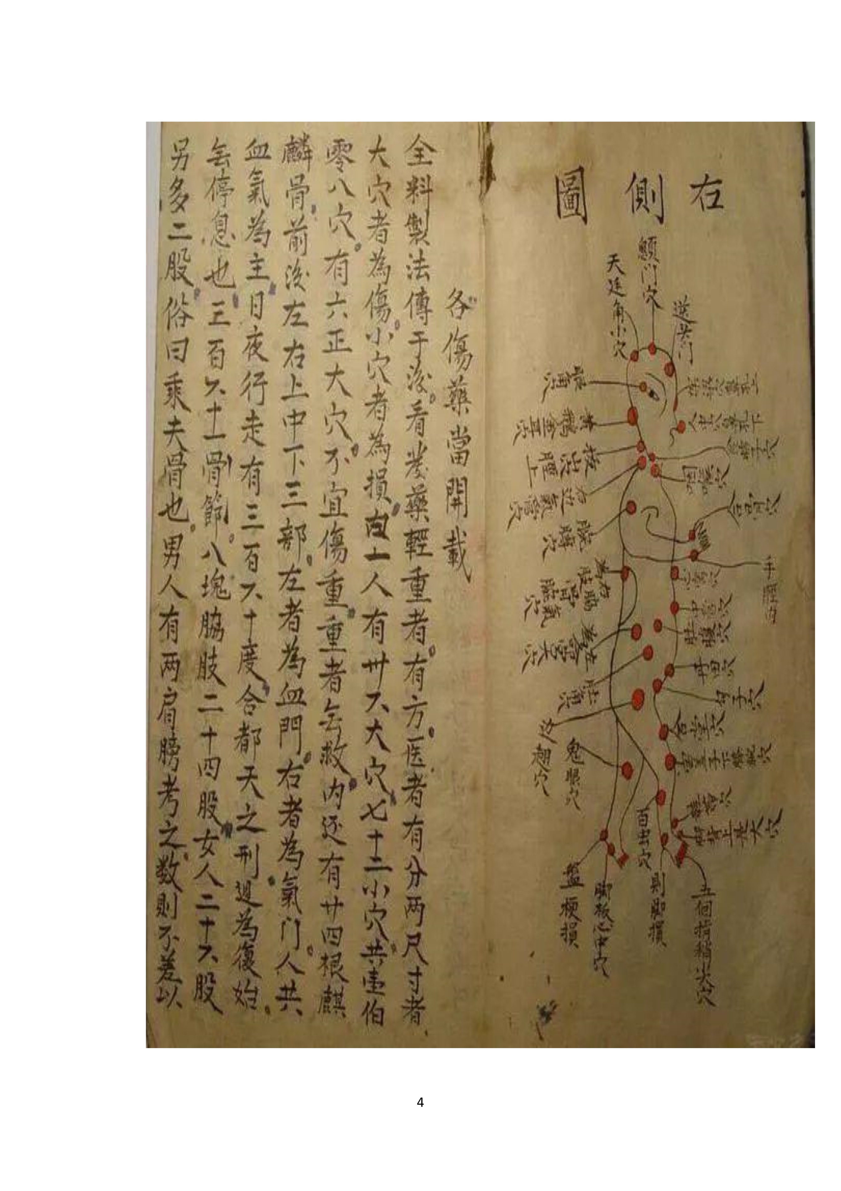 中医古书籍清代带图且内容非常好的手抄跌打损伤良方