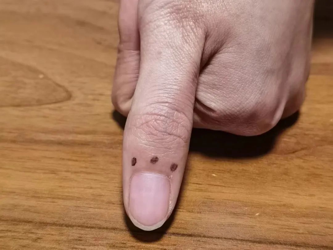 阳了嗓子像刀割一样怎么办,阳了嗓子如刀割吃什么药