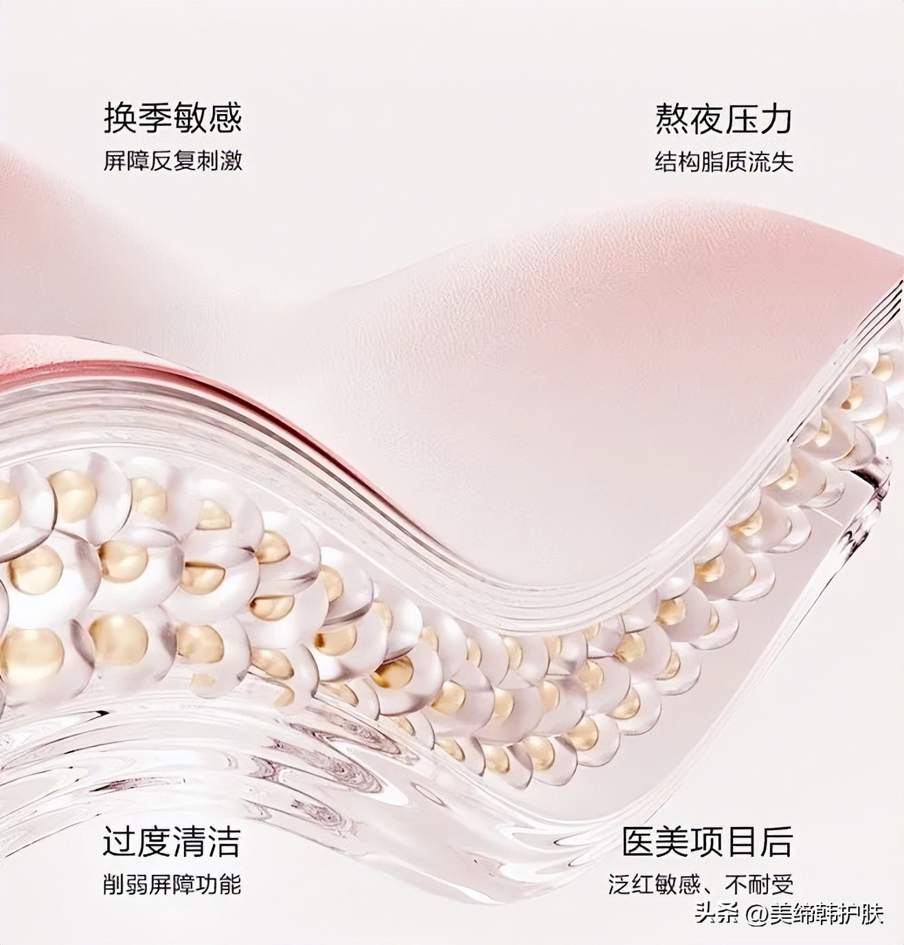 红血丝敏感肌夏天怎么护肤,敏感肌的正确护肤方法