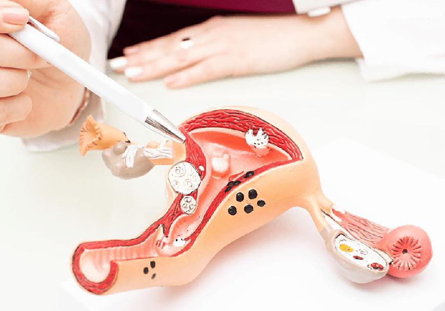 为什么不建议女人去做某些手术，医生用一个个血淋淋的例子告诉你