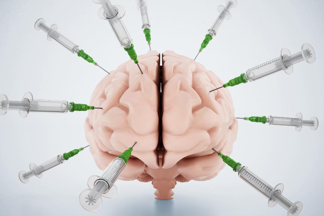 脑动静脉畸形介入手术风险,脑动静脉畸形无症状需要治疗吗