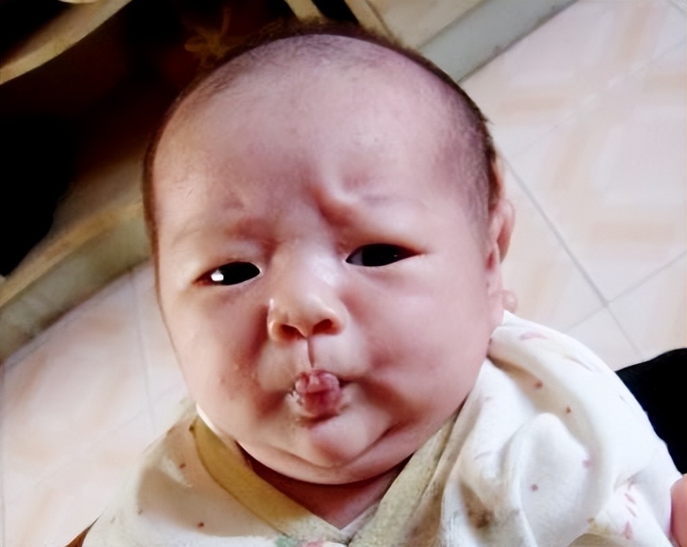 婴儿一激动就打嗝咋回事,胃胀打嗝放屁多体重下降