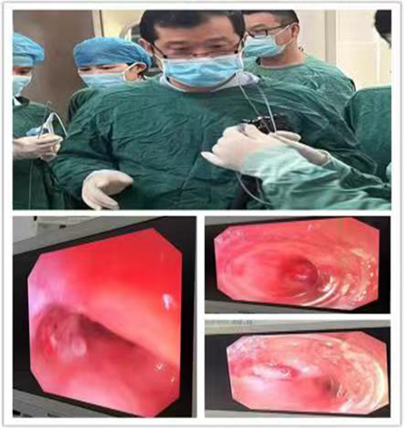 安医大第一附属医院肿瘤外科,安医大第一附属安庆医院照片