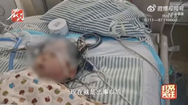 太粗心！因家长疏忽，1岁男童摔倒2个月后突然重度昏迷、离奇病危
